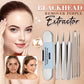 🎉 2026 Sale — Over 37,000 Sold! 🧴 Medical Grade Blackhead Extraction Tool Kit｜Professional Pimple & Blemish Remover Set 🎈✨