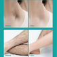 🔥Painless Full Body Hair Removal Cream for Men & Women– Skin-friendly for all areas🌿Delivered within 5 working days☀️