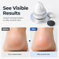 🔥50% off limited time！Professional Electric Foot Callus Shaver